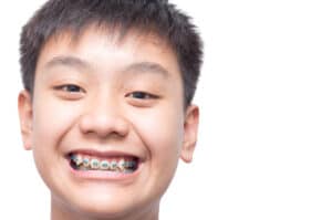 pediatric_orthodontist_braces