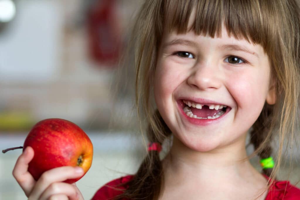 How to Prevent Toddler Tooth Decay 1 (1)