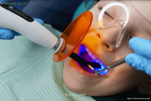 Why Choose a Pediatric Dentist & Safety