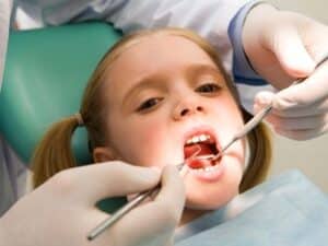 Cavities in baby teeth