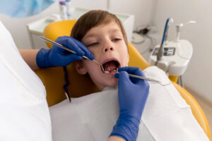 Root Canals in Kids