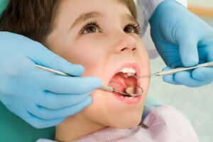 What causes cavities in children